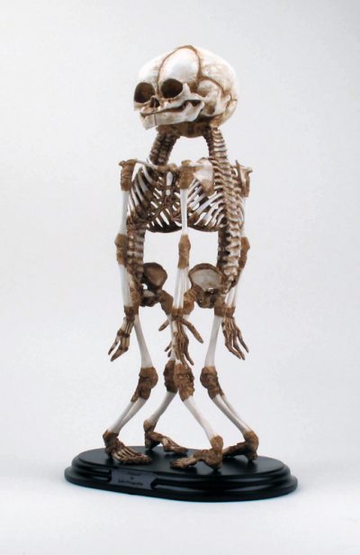 A-Baby Skeleton